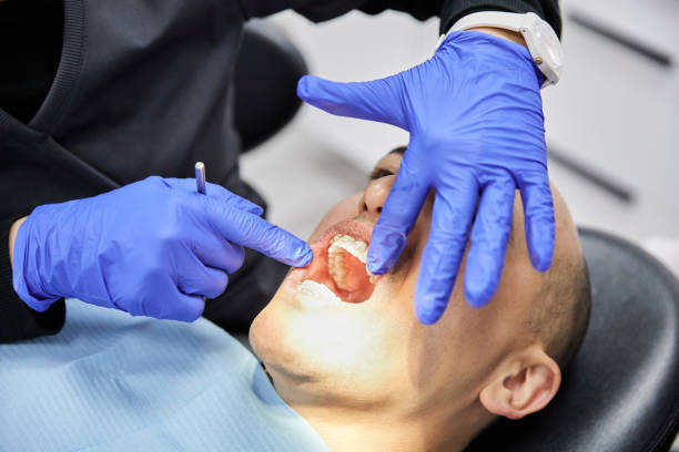 Best Broken or Chipped Tooth Repair in Painted Post, NY